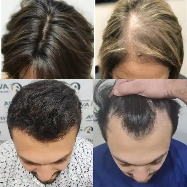 Dealyno Shop مجموعة العناية بالشعر من ميل بإكليل الجبل