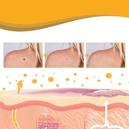 dealyno Tag Recede بخاخ التآليل بسم النحل